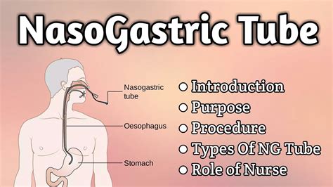Nasogastric Tube Intubation Youtube