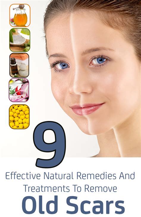 9 Effective Natural Remedies And Treatments To Remove Old Scars