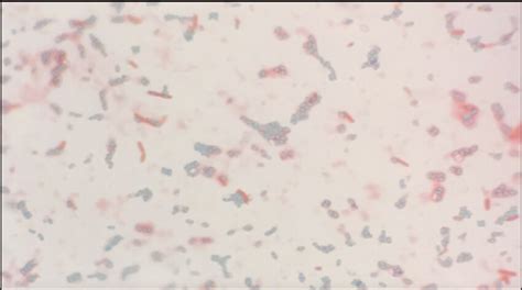 Image Of Spore Endospore And Vegetative Cell Forms Of Bacillus