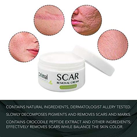 Scar Removal Cream For Old Scars Stretch Mark Removal Cream For Men