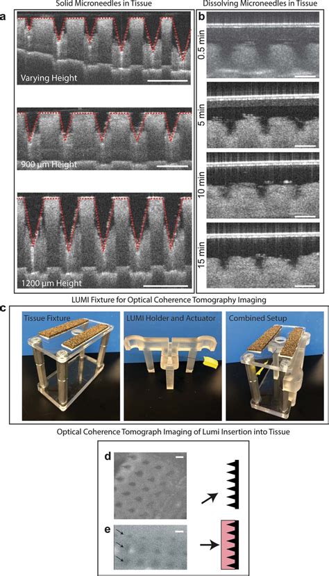 Optical Coherence Tomography OCT Images Of Microneedle Penetration A Download Scientific