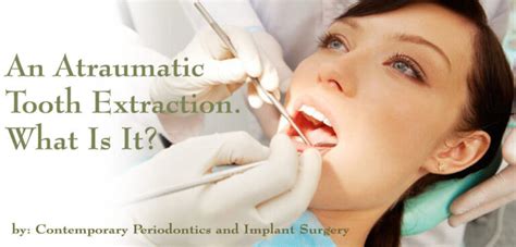 An Atraumatic Tooth Extraction What Is It