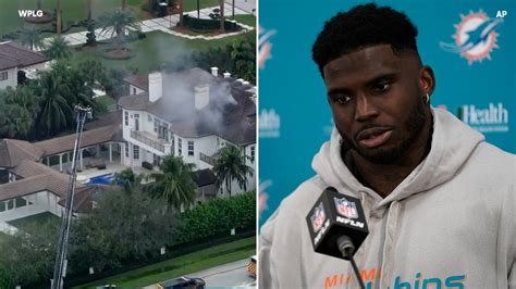 Tyreek Hill South Florida Mansion Fire Started By Child Playing With A