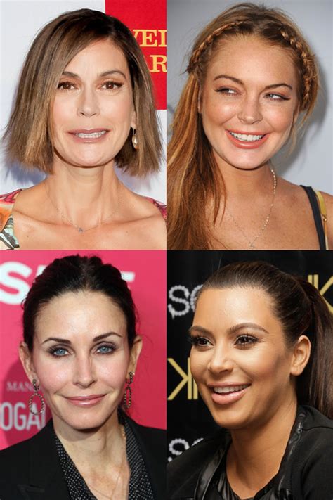 Celebrities With Botox