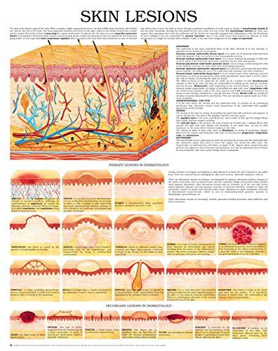 Skin Lesions E Chart Full Illustrated Ebook Hc Healthcomm