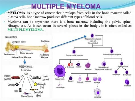 Multiples Myelom Was Ist Bei Der Auswahl Der Richtigen Behandlung Zu