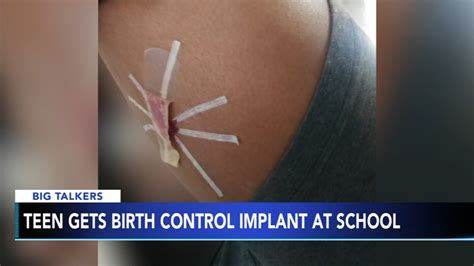 Privacy about their birth control while living with their parents. Mother furious teen was given birth control implant at ...