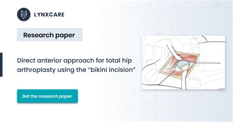 Publication Direct Anterior Approach For Total Hip Arthroplasty Using The Bikini Incision