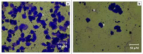 Representative ×100 Images Of Gentian Violet Stained Exfoliative