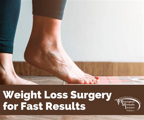Which Surgery Helps You Lose Weight The Fastest Birmingham Minimally