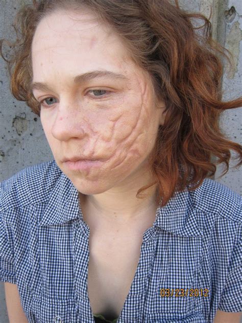 Silicone Scar Applied By Tomscreatures On Deviantart Scar Makeup