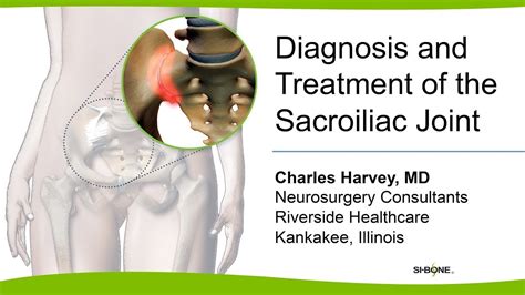 Diagnosis And Treatment Of The Sacroiliac Joint Charles Harvey Md