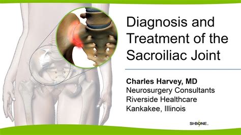 Diagnosis And Treatment Of The Sacroiliac Joint Charles Harvey MD