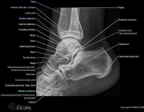 The human foot has 26 bones and 33 joints. ankle-lateral-view-x-ray | Radiology student, Medical ...