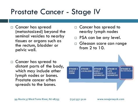 What Is Stage 9 Prostate Cancer Brittany Roy S Blog