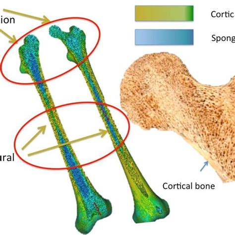 Cortical And Trabecular Bone Distribution In The Entire Femur Left