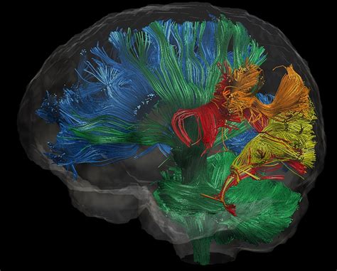 Scanning The Brain To Find Answers Ucl Dementia Ucl University College London