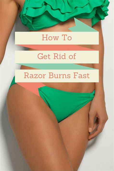 How To Get Rid Of Razor Burns How To Treat Razor Burn Fast