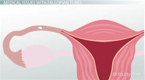 Fallopian Tube Diagram