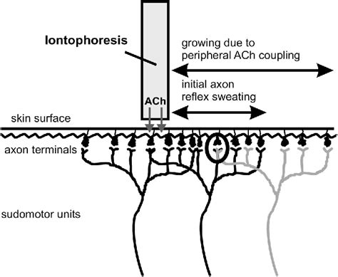 Figure From Spreading Of Sudomotor Axon Reflexes In Human Skin