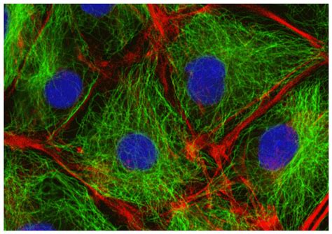 1 Animal Cells The Cytoskeleton Licrotubules In Green And The Actin