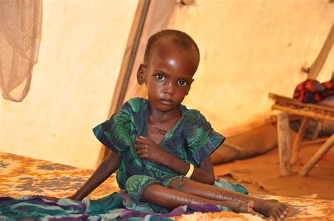 A Malnourished Child In An Msf Treatment Tent In Dolo Ado Flickr