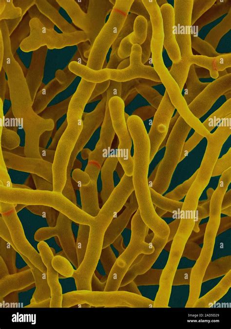 Coloured Scanning Electron Micrograph Sem Of Streptomyces