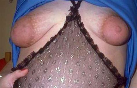 Extreme Saggy Tits Bobs And Vagene