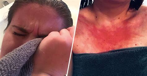 You will sneeze an annoying amount and have itchy eyes. Idaho Woman With Extremely Rare Allergy To Water Can't ...
