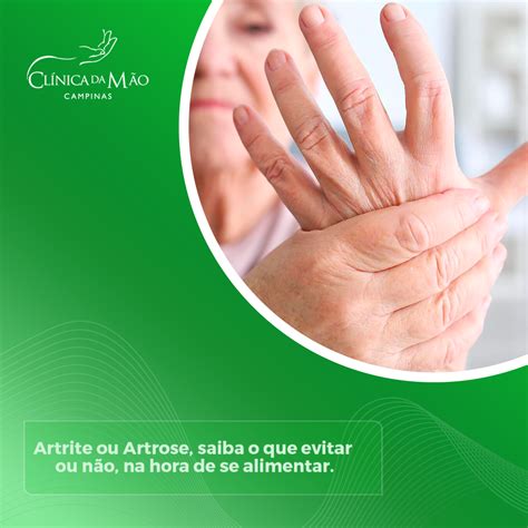 artrite e artrose saiba o que evitar ou não na hora de se alimentar clínica da mão 2021