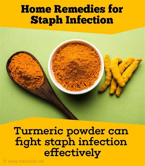 Home Remedies For Staph Infection Staph Infection Infections Home