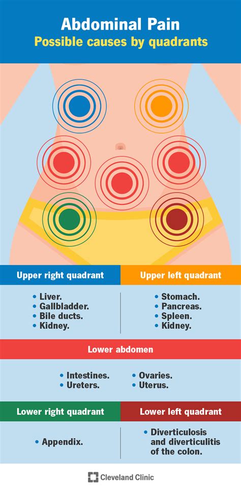 Infographic Abdominal Pain Types Royalty Free Vector Vrogue Co