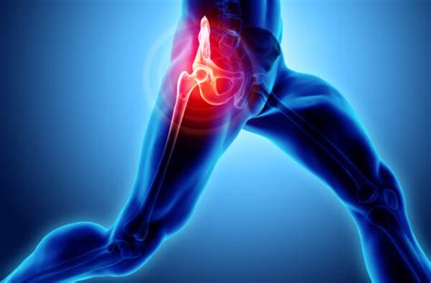 Hip Pain Causes Symptoms And Treatments Briomd