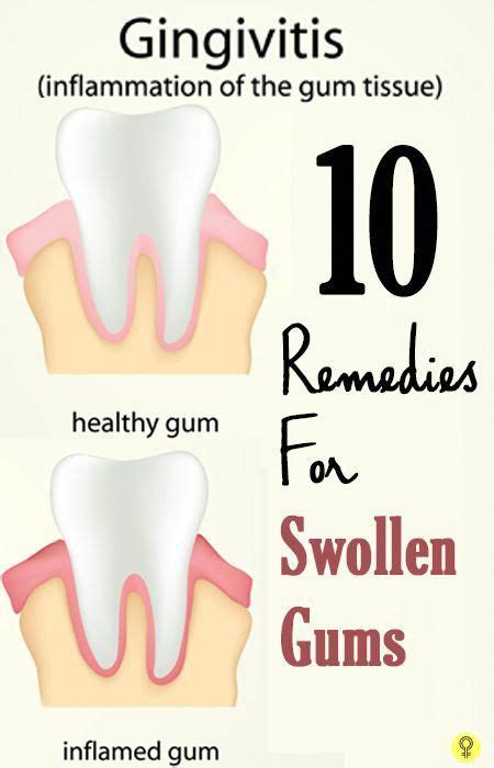 14 Home Remedies To Treat Swollen Gums Causes And Prevention In 2020