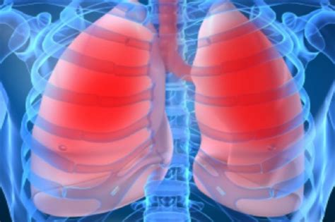 Rak Płuca Główną Przyczyną Wzrostu Zachorowań Na Nowotwory Usługi Medyczne