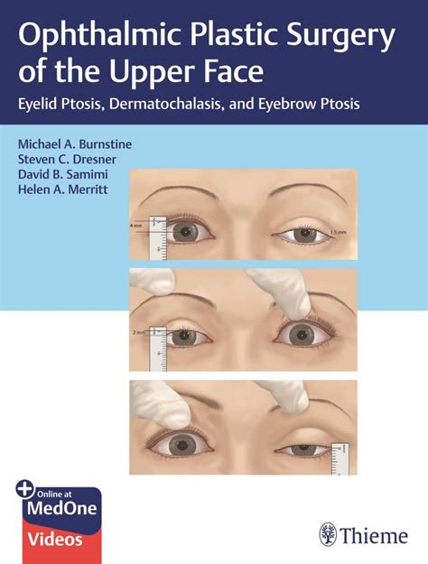 Ophthalmic Plastic Surgery Of The Upper Face Eyelid Ptosis