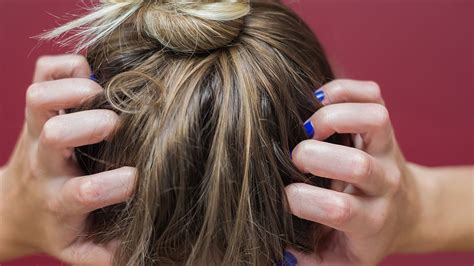 21 Reasons For Your Itchy Scalp Best Health Magazine