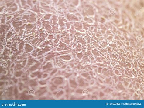 Background Of Dry Unhealthy Skin Texture Close Up Covered With Small