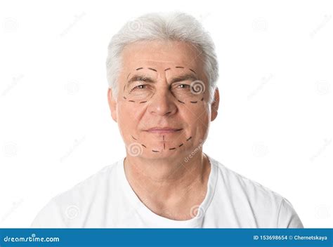 Mature Man With Marks On Face For Cosmetic Surgery Operation Stock