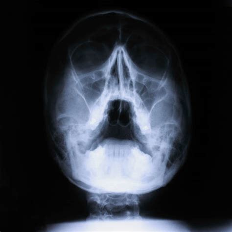 Skull Mouth Open Stock Photos Pictures And Royalty Free Images Istock