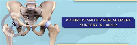 Arthritis And Hip Replacement Surgery In Jaipur