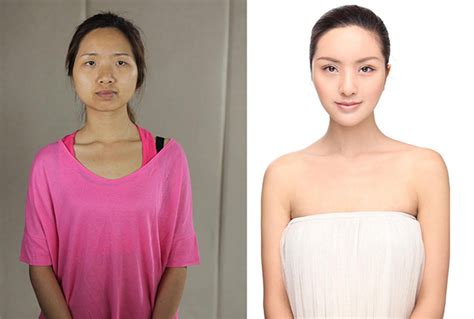 Images Of 20 Chinese Women Before And After Plastic