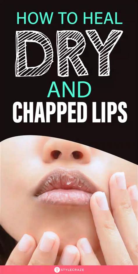 If You Have Dry And Chapped Lips This Is How You Heal Them Artofit