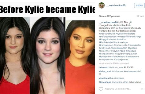 Kylie Jenner è Rifatta Foto E Video Prima E Dopo