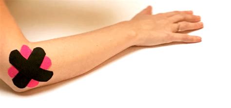 Er zijn drie verklaringen denkbaar; Medical taping