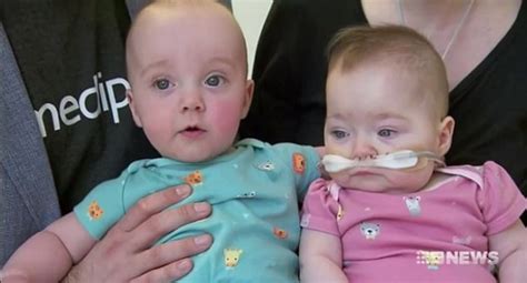 Baby Girl Born Weighing Grams Defies The Odds Of Survival And Reunites With Her Twin
