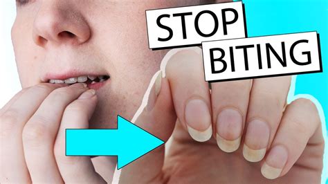 15 Ways To Stop Biting Your Nails Nailed It Nz Youtube