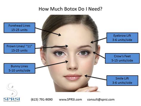 Determine How Much Botox You Will Need Sprsi Blog