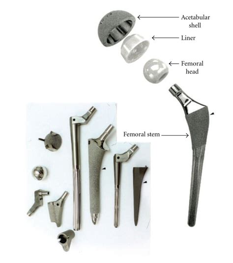 Total Hip Replacement Components And Examples Of Commercial Hip Stem