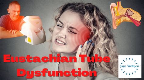 Understanding Eustachian Tube Dysfunction Youtube